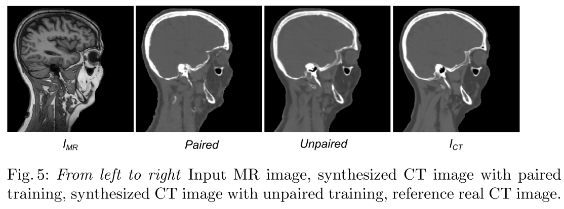 2021-8-14-Deep MR to CT Synthesis using Unpaired Data(MICCAI Workshop ...