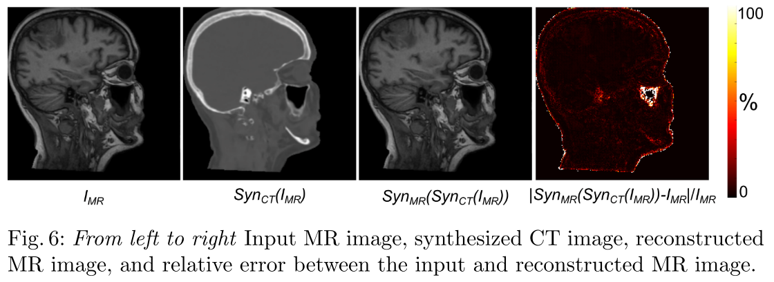 2021-8-14-Deep MR to CT Synthesis using Unpaired Data(MICCAI Workshop ...