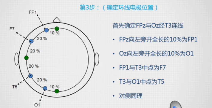 脑电图电极安放位置图图片