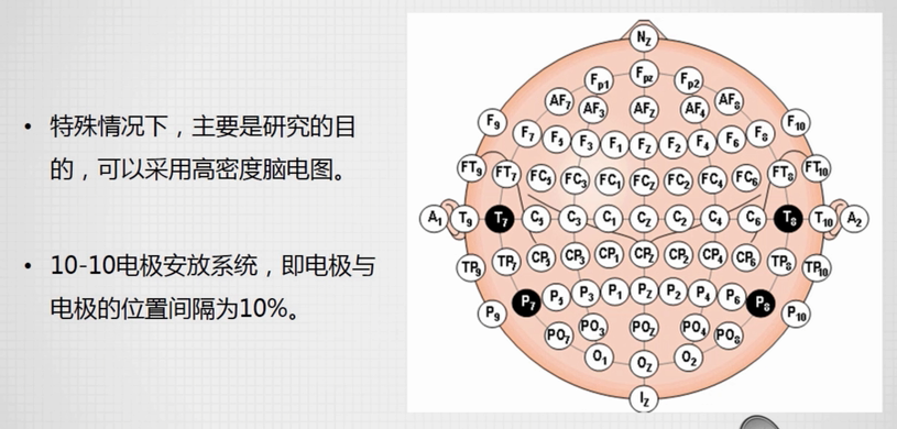 脑电图电极安放位置图图片