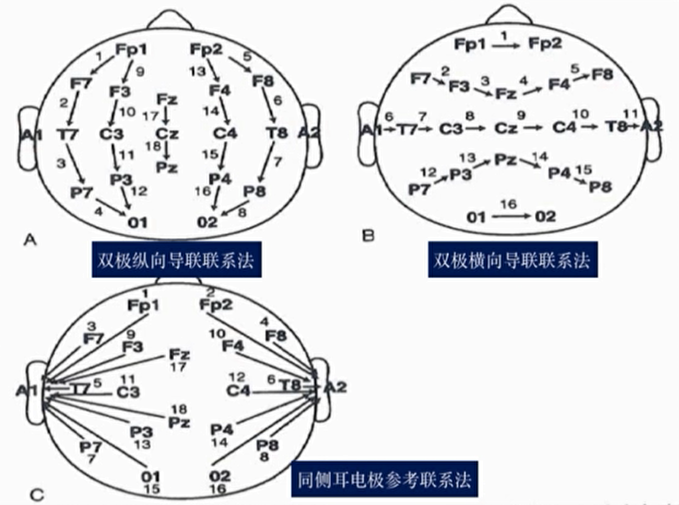 脑电图的位置详细介绍图片