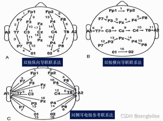 Python成神之路 第二课 脑电图一般判读原则