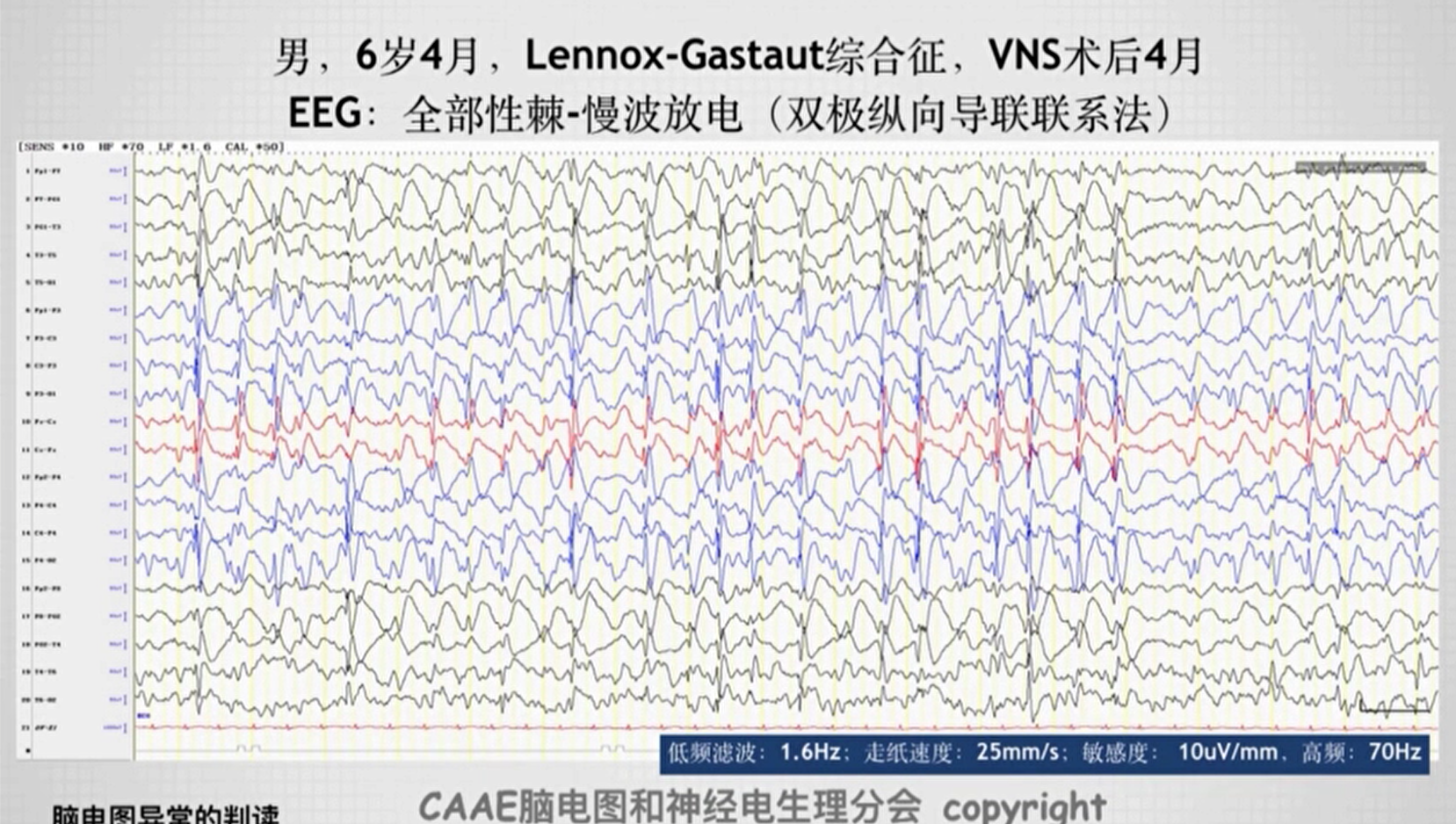 这种波形常见于lennox