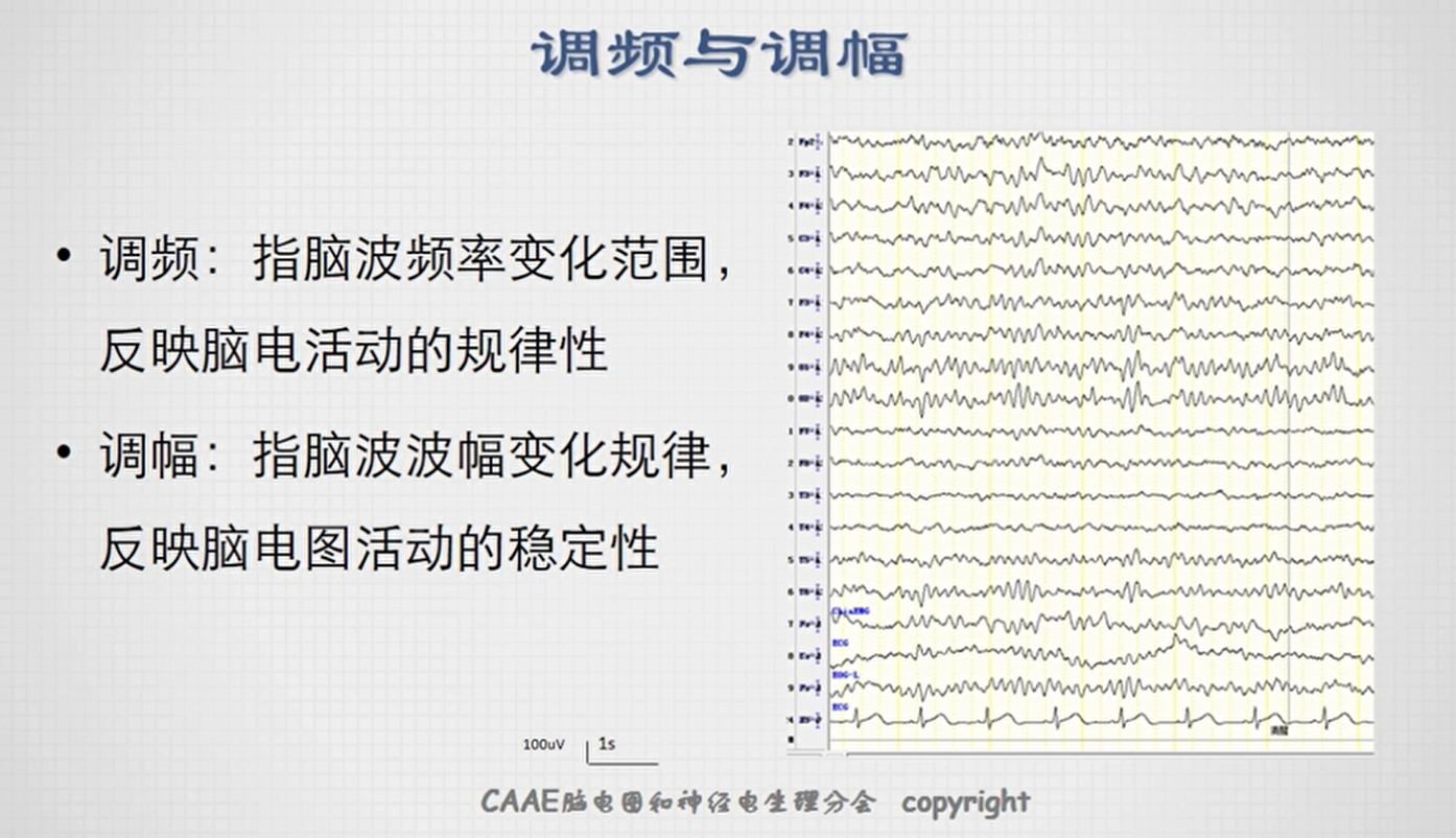 第三课 脑电图波形的分析和识别 Zengleilee的博客 Csdn博客