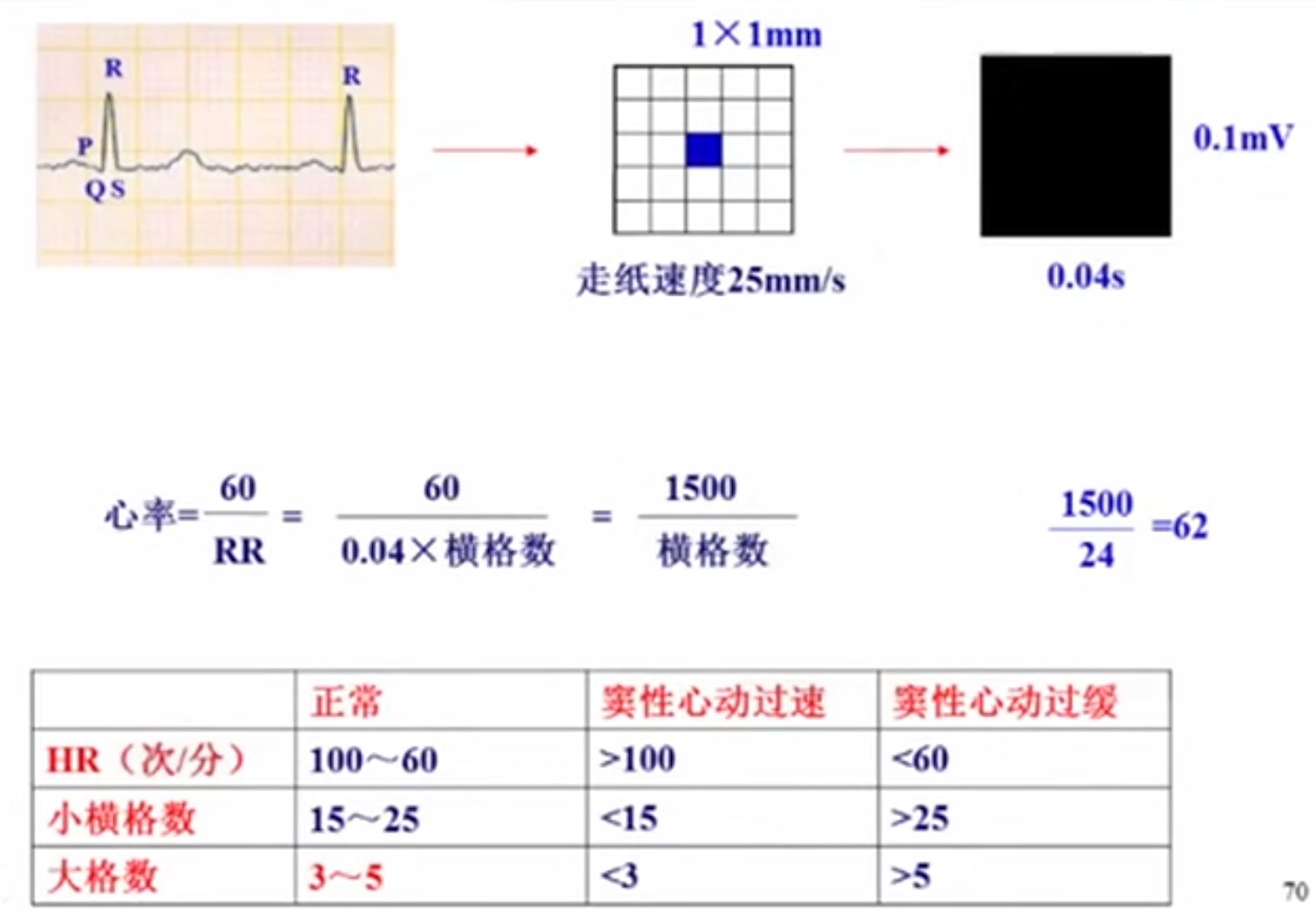 贺银成心电图总结图片