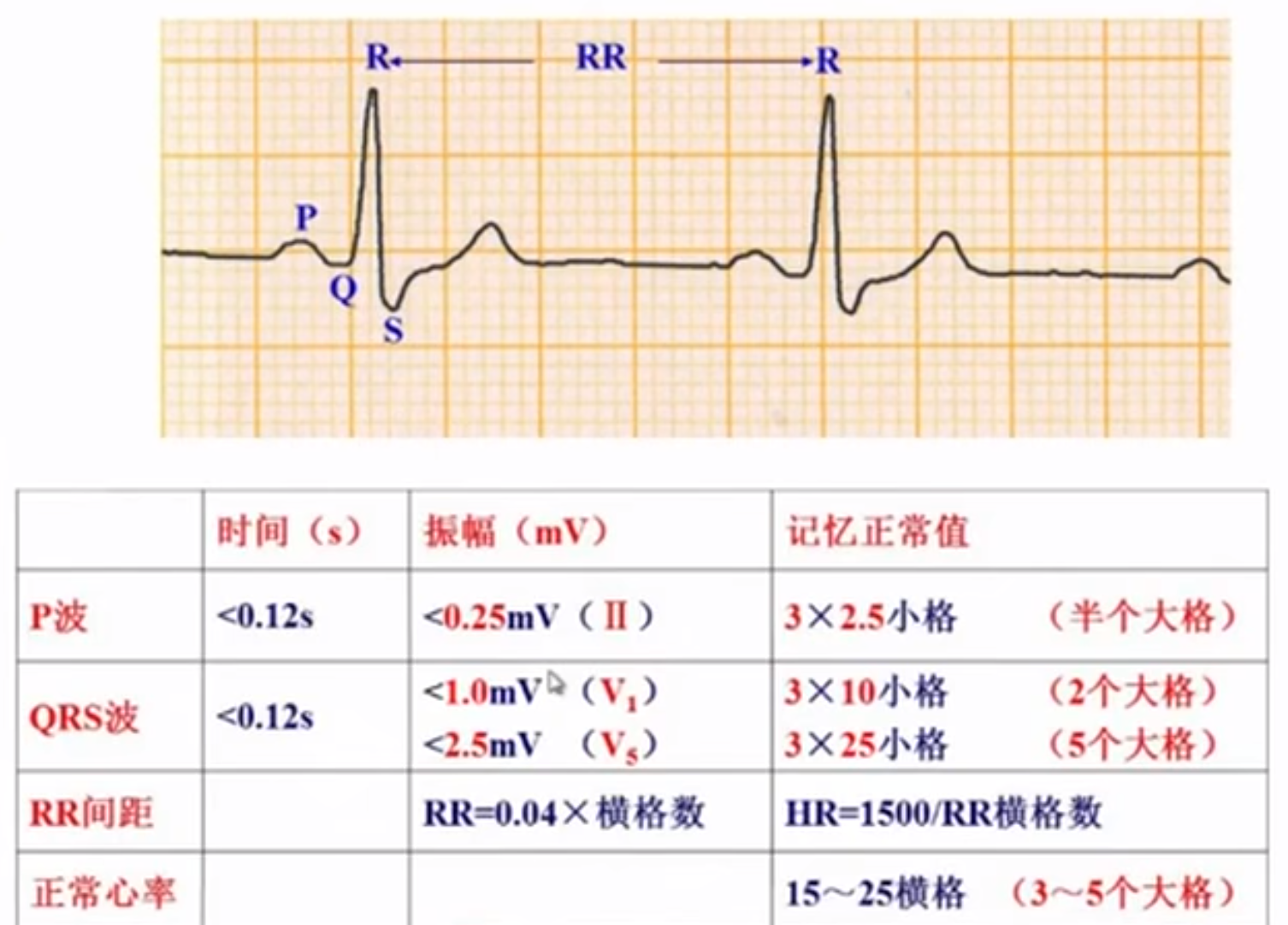 1 心电图的构成