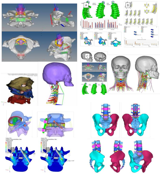 生物力学有限元分析_高等分析力学