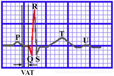 1,定标电压qquad定标电压1cm = 1mv,纵坐标每一小格 = 0.