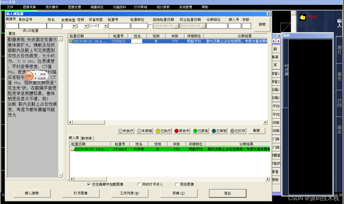 三维PACS系统 医院放射影像后处理源码