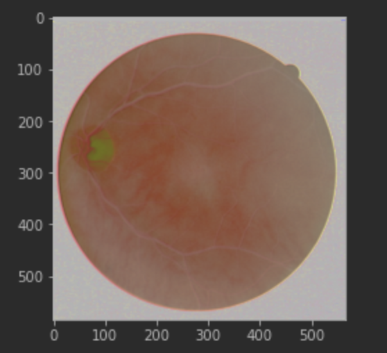 【Opencv】一文搞懂PIL、cv2、pyplot.imshow()显示图片颜色/色彩偏差问题_pil imshowCSDN博客