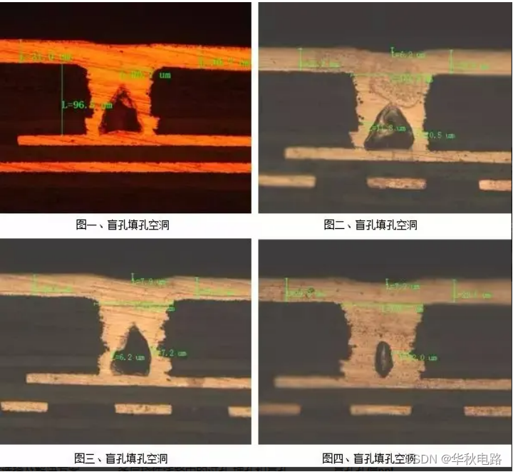 HDI激光钻孔和常见问题