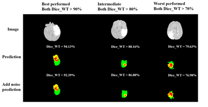 [深度学习论文笔记]3D AGSE-VNet: An Automatic Brain Tumor MRI Data Segmentation Framework