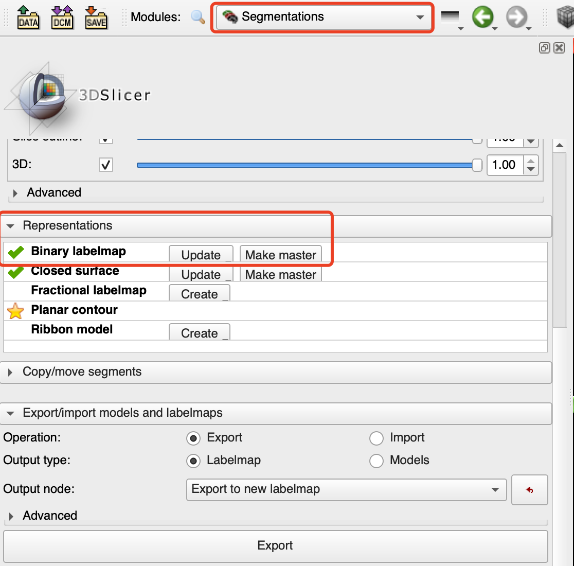 DICOM-RT struct在python中显示mask以及使用3d Slicer转换为nii_吨吨不打野的博客-CSDN博客