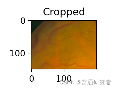 opencv-医学图像预处理