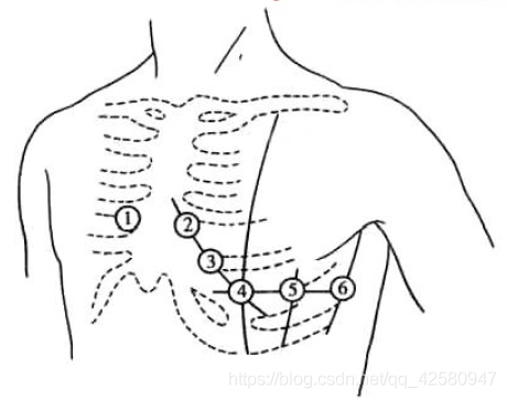 肢体导联和胸导联图片