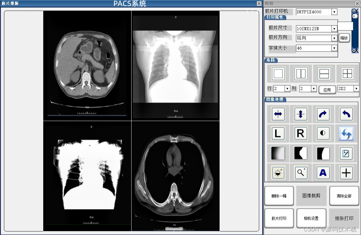 医院信息化PACS系统源码（影像阅片、报告模板、三维重建）