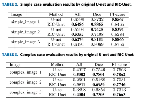 RIC-Unet: An Improved Neural Network Based on Unet for Nuclei Segmentation in Histology Images