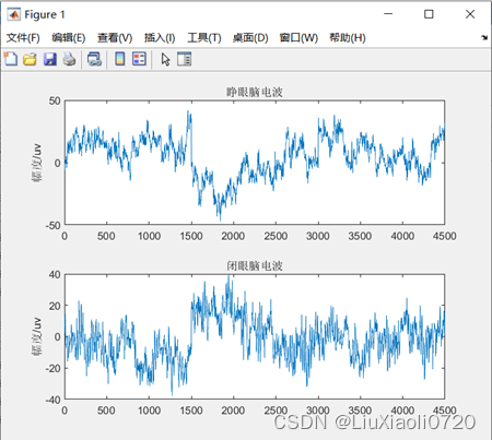 Figure 2.睁闭眼脑电的时域图