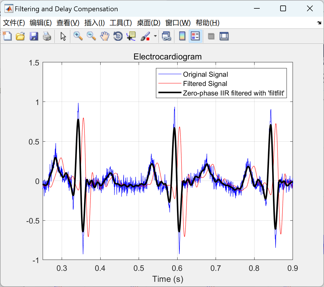 去趋势化一个心电图信号、信号功率谱、低通IIR滤波器并平滑信号、对滤波器引起的延迟进行补偿研究（Matlab代码实现）