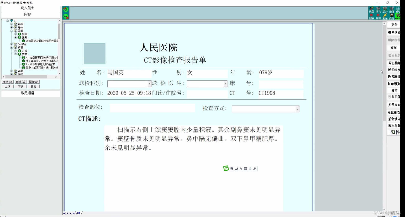 医学影像归档与通讯系统（PACS）系统源码 PACS三维图像后处理技术