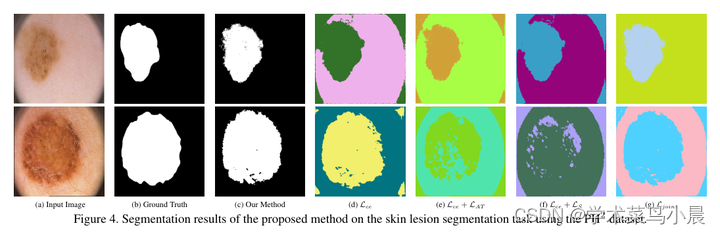 医学图像分割：Self-supervised Semantic Segmentation: Consistency over Transformation