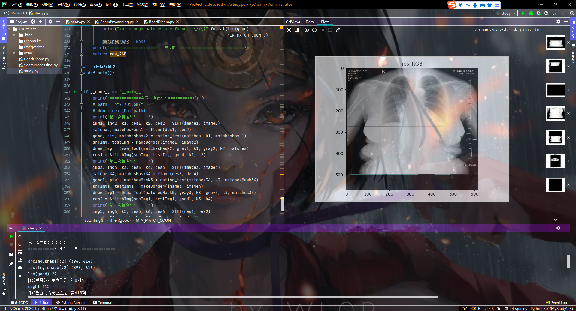 【OpenCV+Python实现医学影像拼接（一）】_医学图像拼接 图-CSDN博客