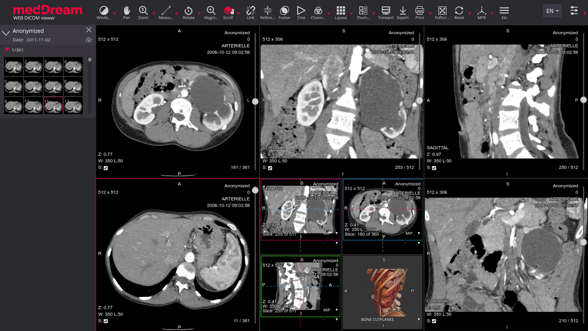 DICOM Demo