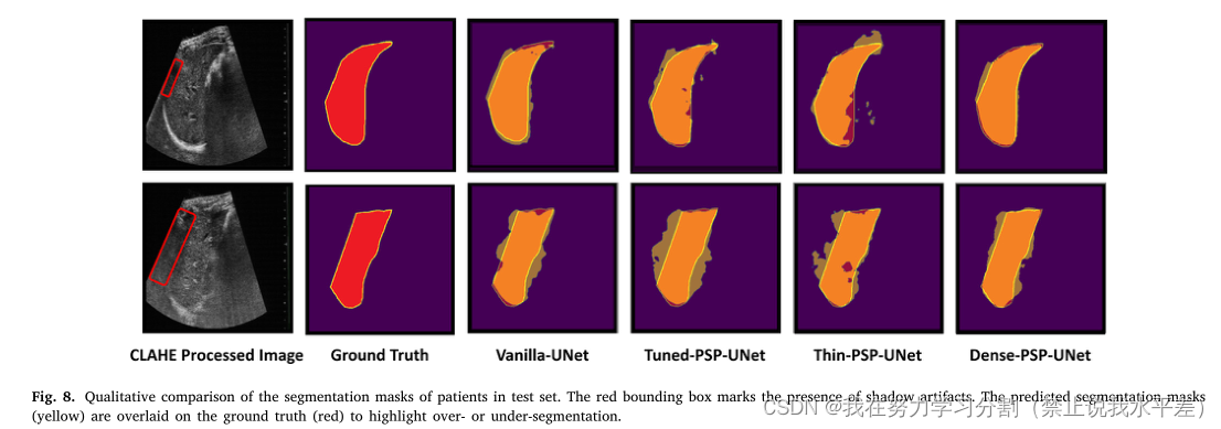 Dense-PSP-UNet: A neural network for fast inference liver ultrasoundsegmentation