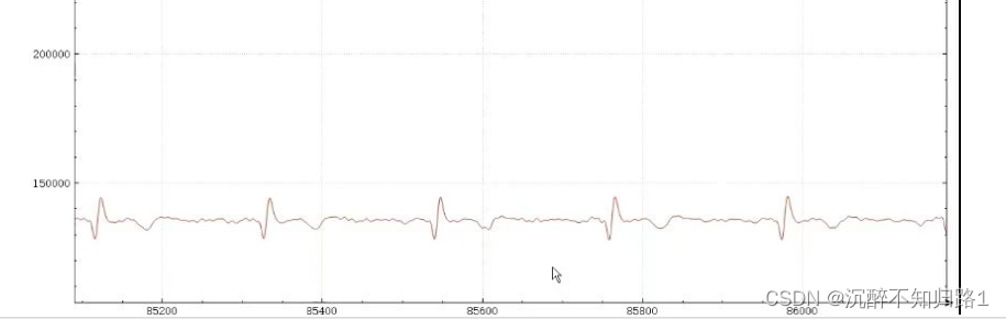 基于stm32的ADS1292R 心电波形采集