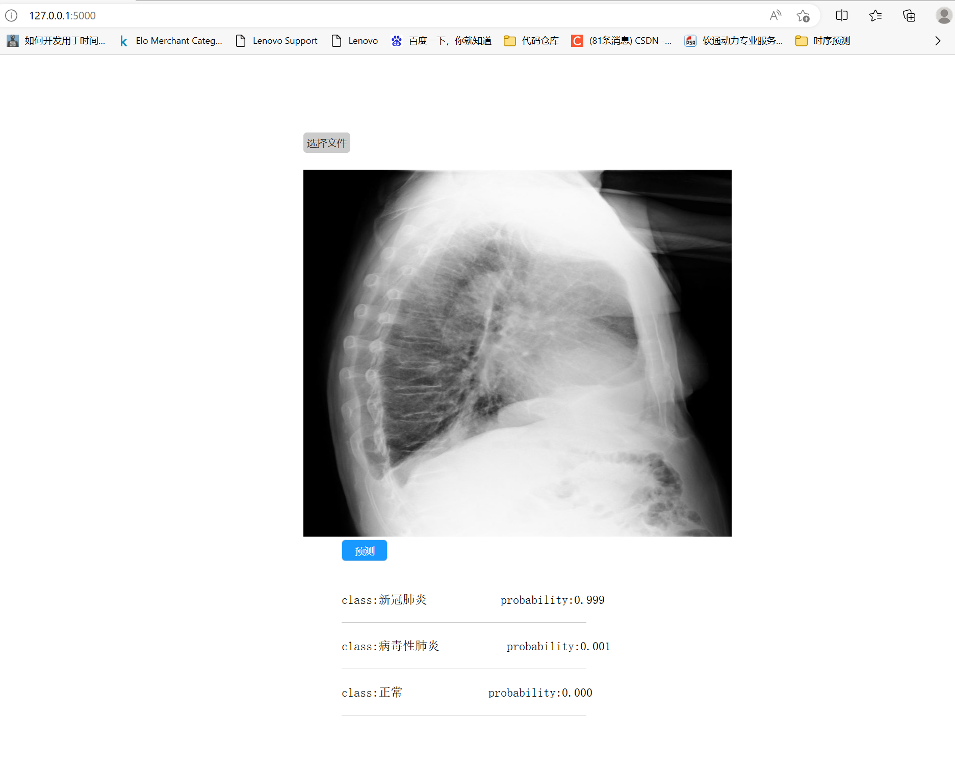 基于Tensorflow搭建卷积神经网络CNN（新冠肺炎医学图像识别）保姆及级教程