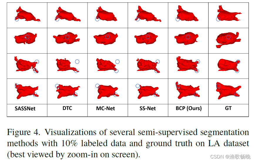 论文解读《Bidirectional Copy-Paste for Semi-Supervised Medical Image ...
