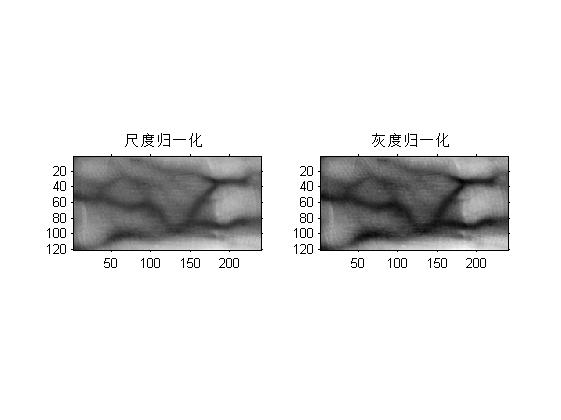 【静脉检测】手指静脉图像检测【含Matlab源码 1654期】