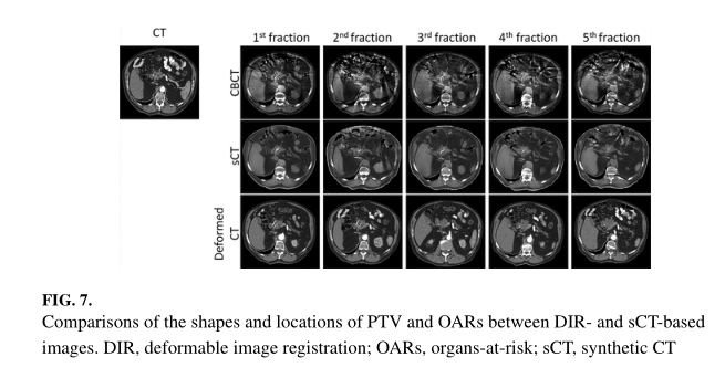 CBCT-based synthetic CT generation using deep-attention cycleGAN for pancreatic adaptiveradiotherapy