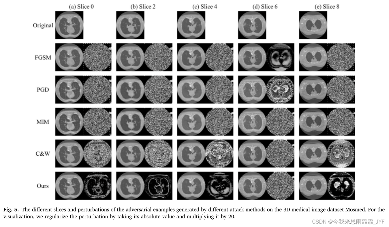 Frequency constraint-based adversarial attack on DNNS for medical image classification（2023 CIBM）