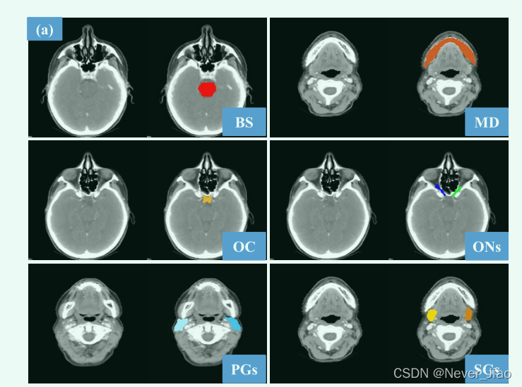 Fig.1.（a）