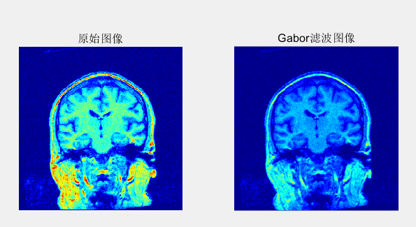 MATLAB---一维Gabor滤波器、gabor滤波器的实部与虚部图像、Gabor滤波器