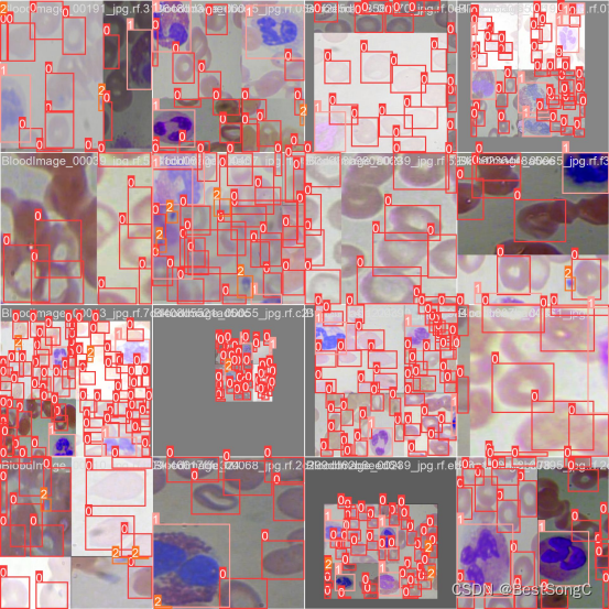 基于深度学习的高精度血小板检测识别系统（PyTorch+Pyside6+YOLOv5模型）