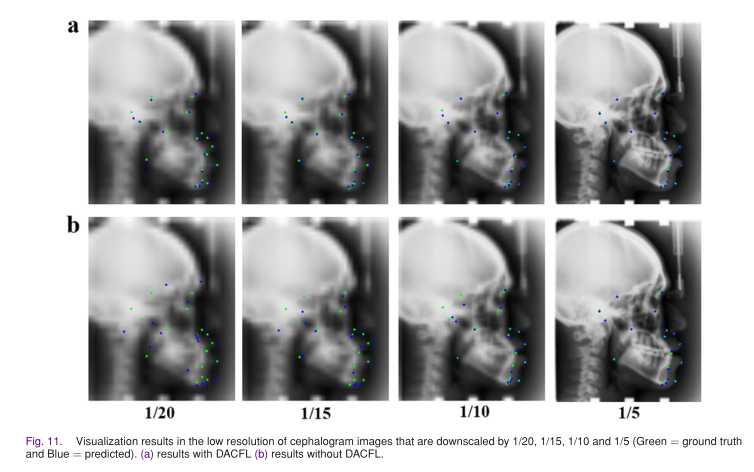 【翻译】Deep Anatomical Context Feature Learning for Cephalometric Landmark ...