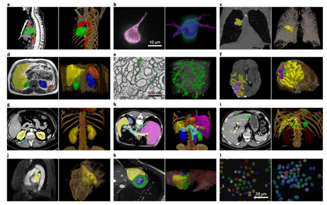 医学图像分割_ctpelvic1k_落花逐流水的博客-csdn博客