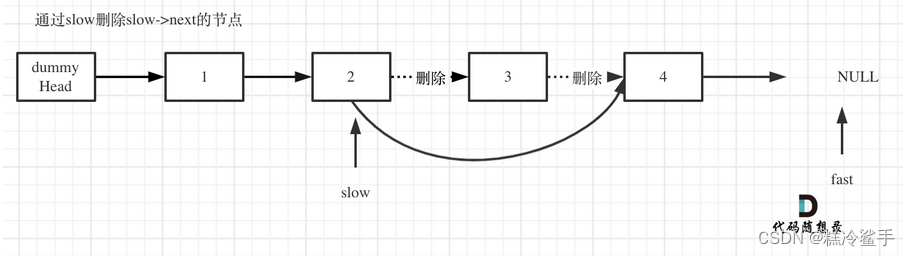 删除链表的倒数第N个节点-双指针法