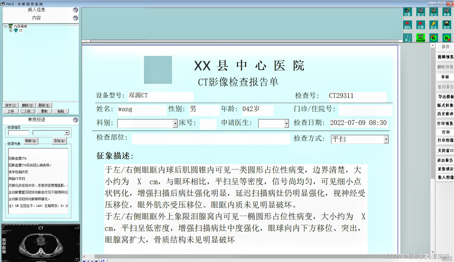 3D医学三维技术影像PACS系统源码