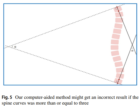 將計算機輔助評價方法與人工評價方法進行比較cobb角測量和脊柱側凸