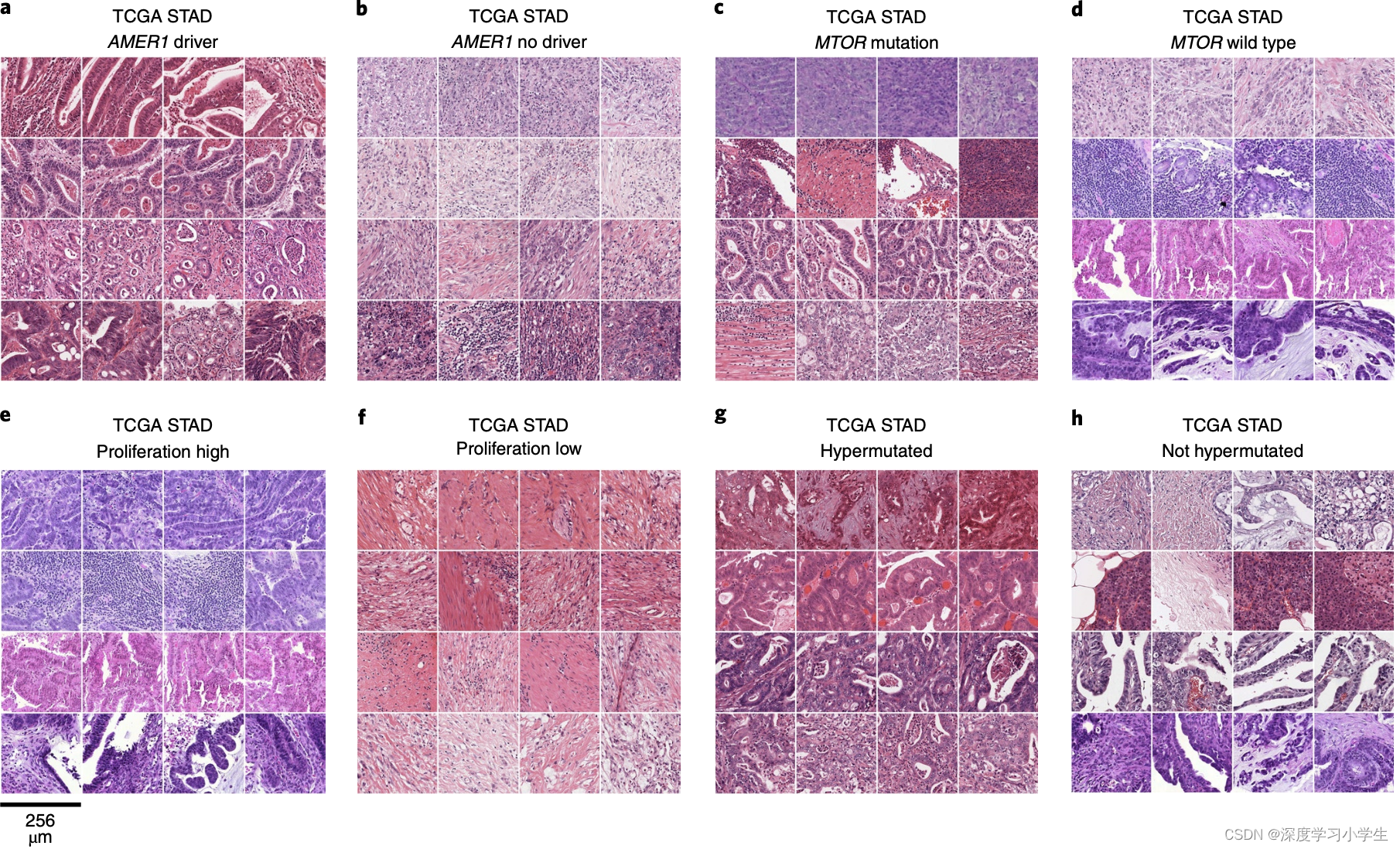 Pan-cancer image-based detection of clinically actionable genetic alternations