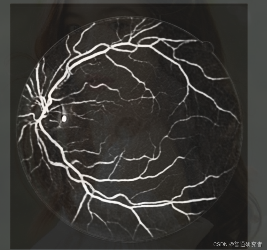 基于U-Net的视网膜血管分割（Pytorch完整版）