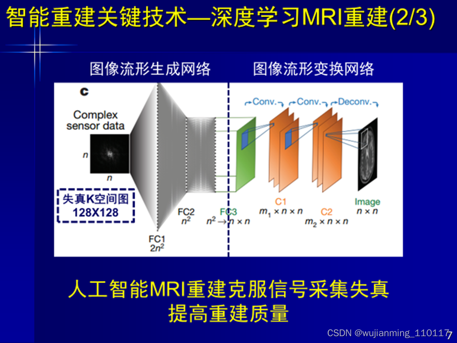 这是前年发表在Nature杂志上的文章，以深度学习进行重建，解决了磁共振从信号到图像的问题。得