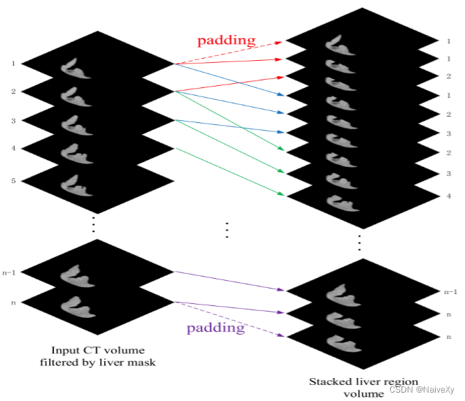 论文笔记X-Net:Multi-branch UNet-like network for liver and tumor ...