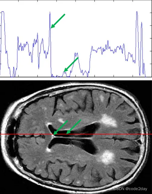 像素强度变化（上）和大脑的 MRI 图像（下）