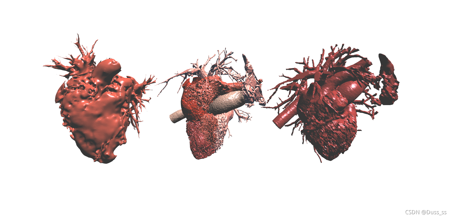 【3DSlicer】基于心脏ct影像重建3d模型及导出