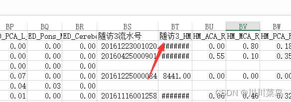 2023华为杯E题：出血性脑卒中临床智能诊疗建模（不断更新）