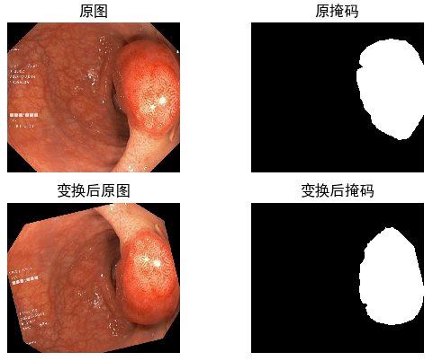 【图像增强】图像分割中Albumentations同时增强原图与掩码